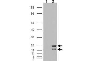 293 overexpressing NRAS and probed with NRAS polyclonal antibody  (mock transfection in first lane), tested by Origene. (GTPase NRas anticorps  (Internal Region))