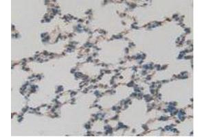 IHC-P analysis of Rat Lung Tissue, with DAB staining. (GATA4 anticorps  (AA 228-440))