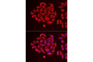 Immunofluorescence analysis of MCF7 cells using TUFM antibody. (TUFM anticorps  (AA 186-455))