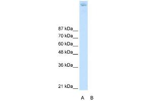 ZBTB38 antibody (20R-1249) used at 0. (ZBTB38 anticorps  (N-Term))
