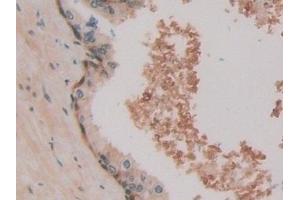 Detection of HSPA1A in Human Prostate Tissue using Polyclonal Antibody to Heat Shock 70 kDa Protein 1A (HSPA1A)