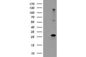Image no. 1 for anti-Regulatory Factor X-Associated Ankyrin Containing Protein (RFXANK) antibody (ABIN1500684) (RFXANK anticorps)