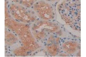 IHC-P analysis of Human Kidney Tissue, with DAB staining. (ENPEP anticorps  (AA 718-948))