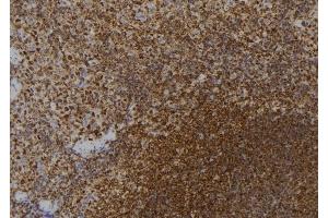 ABIN6257567 and ABIN6273590 at 1/100 staining Mouse spleen tissue by IHC-P.