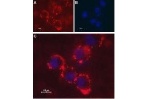 Expression of Latrophilin-1 receptor in SH-SY5Y cell line - Cell surface detection of Latrophilin-1 receptor in intact living human neuroblastoma (SH-SY5Y) cells. (Latrophilin 1 anticorps  (Extracellular, N-Term))