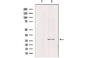 Western blot analysis of extracts from HepG2, using FGF23 Antibody. (FGF23 anticorps  (Internal Region))