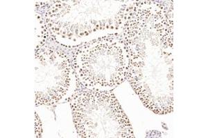 Immunohistochemistry analysis of paraffin-embedded rat testis using,AF10 (ABIN7075234) at dilution of 1: 1200 (MLLT10 anticorps)