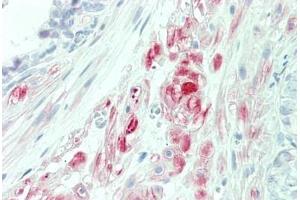 Human Prostate: Formalin-Fixed, Paraffin-Embedded (FFPE)