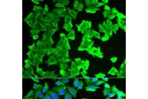 Immunofluorescence analysis of HeLa cells using RPLP0 Polyclonal Antibody (RPLP0 anticorps)