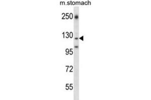 Western Blotting (WB) image for anti-Laminin, gamma 2 (LAMC2) antibody (ABIN2997656) (LAMC2 anticorps)
