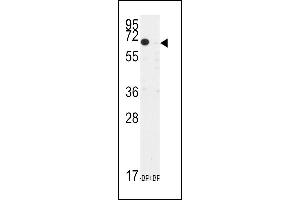 Western blot analysis of anti-TIEG Antibody (N-term) (ABIN392159 and ABIN2841880) pre-incubated with and without blocking peptide in CEM cell line lysate.