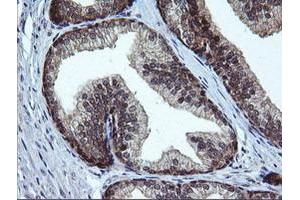 Image no. 7 for anti-RAB37, Member RAS Oncogene Family (RAB37) antibody (ABIN1500561)