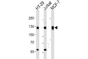 Western blot analysis of lysates from HT-29, Jurkat, MCF-7 cell line (from left to right), using SMG7 Antibody (C-term) (ABIN6244188 and ABIN6577686). (SMG7 anticorps  (C-Term))