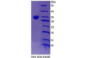 SDS-PAGE (SDS) image for Cullin 1 (CUL1) (AA 1-250) protein (His tag) (ABIN4989233) (Cullin 1 Protein (CUL1) (AA 1-250) (His tag))