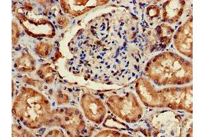 Immunohistochemistry of paraffin-embedded human kidney tissue using ABIN7143447 at dilution of 1:100 (ARF4 anticorps  (AA 1-180))