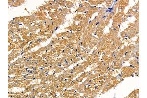 ABIN6261215 and ABIN6277963 at 1/100 staining rat heart tissue by IHC-P.