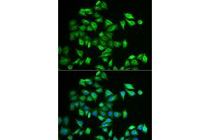 Immunofluorescence analysis of A549 cell using POMGNT2 antibody. (C3orf39 anticorps)