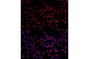 Immunofluorescence analysis of 293T cells using XRCC4 antibody (ABIN3022381, ABIN3022382, ABIN3022383 and ABIN6218772) at dilution of 1:100.
