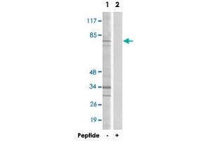 Western blot analysis of extracts from HepG2 cells, using DDX51 polyclonal antibody . (DDX51 anticorps  (C-Term))