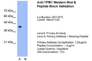 Host:  Rabbit  Target Name:  TPM1  Sample Type:  HepG2  Lane A:  Primary Antibody  Lane B:  Primary Antibody + Blocking Peptide  Primary Antibody Concentration:  1. (Tropomyosin anticorps  (N-Term))