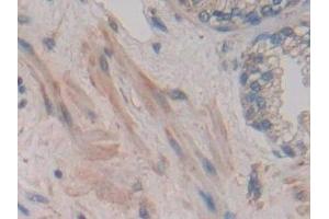 Detection of JAG2 in Human Prostate Tissue using Polyclonal Antibody to Jagged 2 Protein (JAG2)