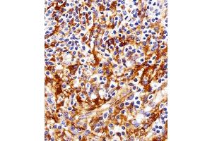Immunohistochemical analysis of paraffin-embedded H. (FYN anticorps)