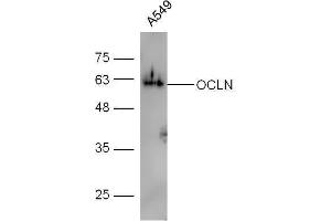 Human A549 lysates probed with Rabbit Anti-Occludin Polyclonal Antibody, Unconjugated  at 1:5000 for 90 min at 37˚C.