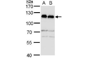 WB Image alpha Adducin antibody detects alpha Adducin protein by western blot analysis. (alpha Adducin anticorps)
