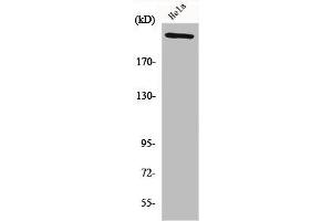 Western Blot analysis of HeLa cells using FN1 Polyclonal Antibody
