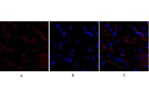 Immunofluorescence analysis of mouse liver tissue. (p53 anticorps)