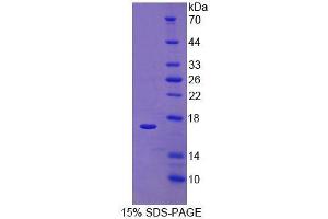 SDS-PAGE analysis of Human RalA Binding Protein 1 Protein. (RALBP1 Protéine)