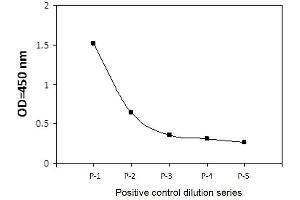 Jurkat cells were treated with Pervanadate.