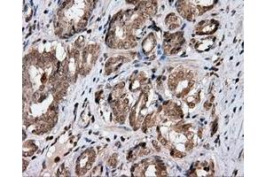 Immunohistochemical staining of paraffin-embedded Kidney tissue using anti-CISD1 mouse monoclonal antibody. (CISD1 anticorps)