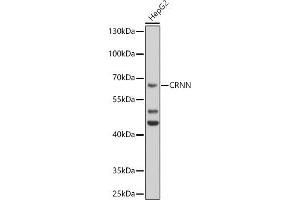Western blot analysis of extracts of HepG2 cells, using CRNN antibody (ABIN6127877, ABIN6139056, ABIN6139057 and ABIN6224784) at 1:1000 dilution. (CRNN anticorps  (AA 396-495))