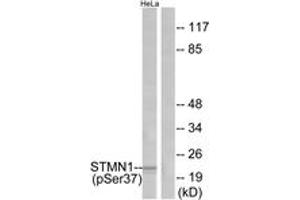 Western blot analysis of extracts from HeLa cells treated with nocodazole, using Stathmin 1 (Phospho-Ser37) Antibody. (Stathmin 1 anticorps  (pSer38))