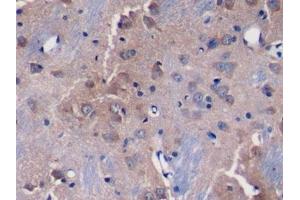 Detection of DKK3 in Rat Cerebrum Tissue using Polyclonal Antibody to Dickkopf Related Protein 3 (DKK3)