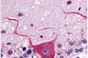 Human Brain, Cerebellum (formalin-fixed, paraffin-embedded) stained with GPR32 antibody ABIN213488 at 20 ug/ml followed by biotinylated goat anti-rabbit IgG secondary antibody ABIN481713, alkaline phosphatase-streptavidin and chromogen.