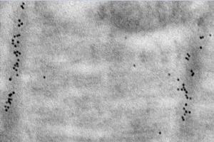 Immunoelectron microscopy analysis of LR white resin-embedded mouse heart using alpha Actinin 2 (ABIN7075510) at dilution of 1: 50. (Sarcomeric alpha Actinin anticorps)