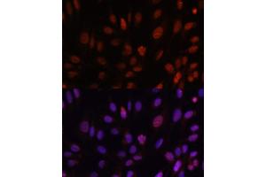 Immunofluorescence analysis of U-2 OS cells using HOXB1 antibody (ABIN6128032, ABIN6141942, ABIN6141943 and ABIN6222309) at dilution of 1:100.