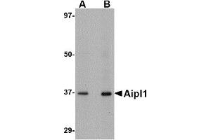 Western Blotting (WB) image for anti-Aryl Hydrocarbon Receptor Interacting Protein-Like 1 (AIPL1) (C-Term) antibody (ABIN1030229) (AIPL1 anticorps  (C-Term))