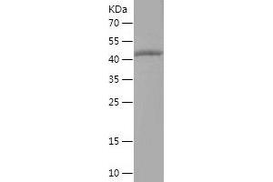 Western Blotting (WB) image for Tripartite Motif Containing 15 (TRIM15) (AA 5-215) protein (His-IF2DI Tag) (ABIN7284076) (TRIM15 Protein (AA 5-215) (His-IF2DI Tag))