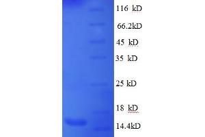 SDS-PAGE (SDS) image for Brain-Derived Neurotrophic Factor (BDNF) (AA 136-243), (partial) protein (His tag) (ABIN5713036) (BDNF Protein (AA 136-243, partial) (His tag))