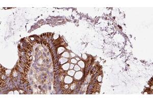 ABIN6272885 at 1/100 staining Mouse colon tissue by IHC-P. (Pallidin anticorps  (C-Term))