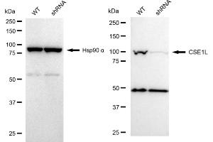Western blotting analysis using CSE1L antibody (ABIN7798172).
