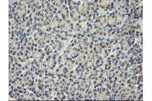 Image no. 2 for anti-SEC14 and Spectrin Domains 1 (SESTD1) antibody (ABIN1501065) (SESTD1 anticorps)