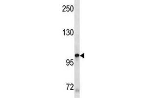KIT antibody western blot analysis in A549 lysate (KIT anticorps)