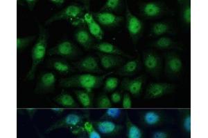 Immunofluorescence analysis of HeLa cells using ZWINT Polyclonal Antibody at dilution of 1:100 (40x lens).
