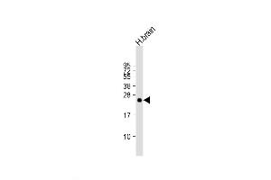 Western Blot at 1:2000 dilution + human brain lysate Lysates/proteins at 20 ug per lane.