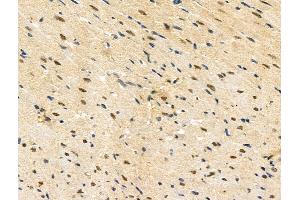 ABIN7093251 and ABIN7097268 at 1/100 staining Rat heart tissue by IHC-P. (ETS1 anticorps  (pThr38))