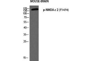 Western Blot (WB) analysis of Mouse Brain using p-NMDAepsilon2 (Y1474) antibody. (NMDA epsilon 2 (pTyr1474) anticorps)